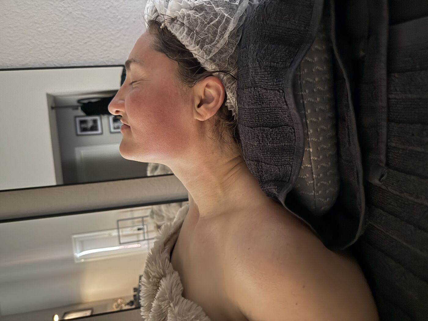 Direkt nach der Madero Beauty Anwendung